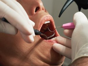 A dentist performing a check-up on a patient