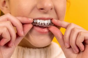Using a retainer to keep teeth healthy and aligned