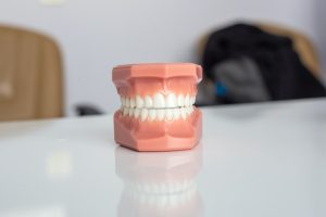 model of teeth